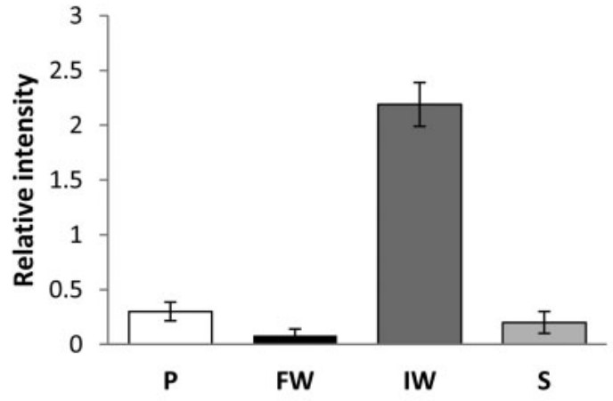 Computer-assisted semiquantitative analysis of the overall relative intensity of the GdA reactive spots.jpg